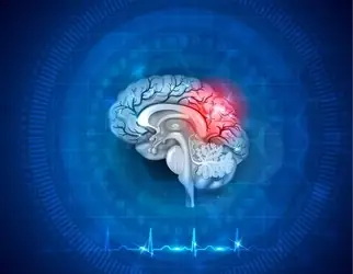 A recent study found that artificial intelligence technology has tripled the amount of UK stroke patients who are capable of performing daily activities as a result of their recovery from stroke. AI-powered technology sees major updates in UK stroke treatment. Researchers found that by using the technology, over 111,000 guess stroke patients had a reduction of over 60 minutes between being notice by a doctor and starting treatment. 